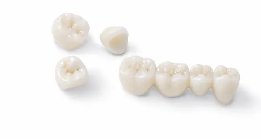 corone in zirconio e ceramica