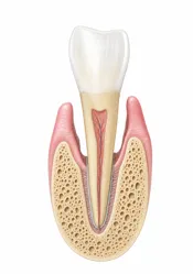 gif animata parodontite ai denti